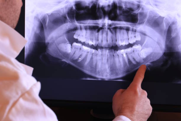 Best Broken or Chipped Tooth Repair in York Harbor, ME