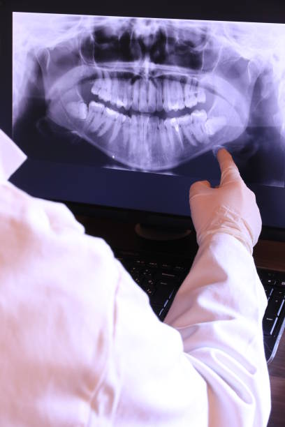 Best Broken or Chipped Tooth Repair in York Harbor, ME