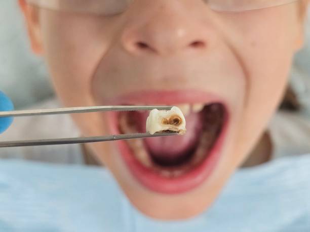 Best Emergency Denture Repair in York Harbor, ME
